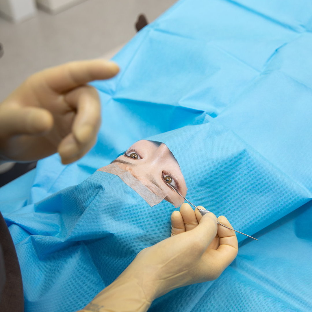 埋没法の手術の様子