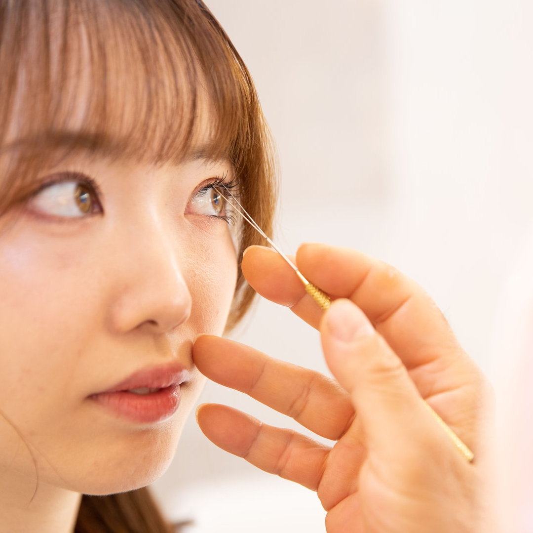 眼瞼下垂 眼瞼下垂手術＋目頭切開 - 銀座S美容・形成外科クリニック