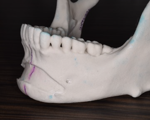 3Dプリンタとクレイモデル(粘土モデル)を使って実際の人工骨を再現3