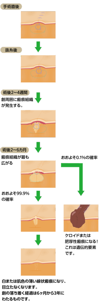 創の経過