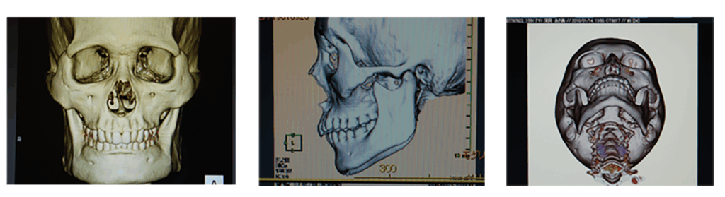 3DCT画像