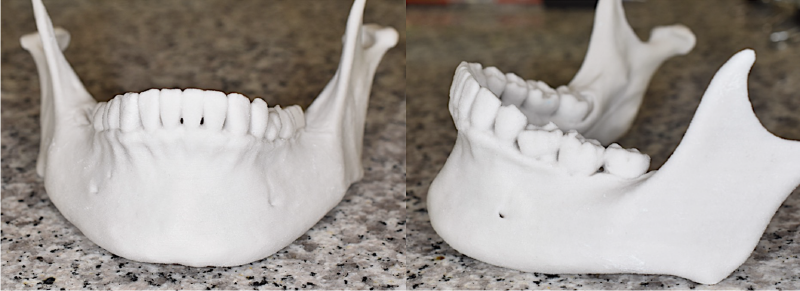 CTデータから作成した3Dモデル