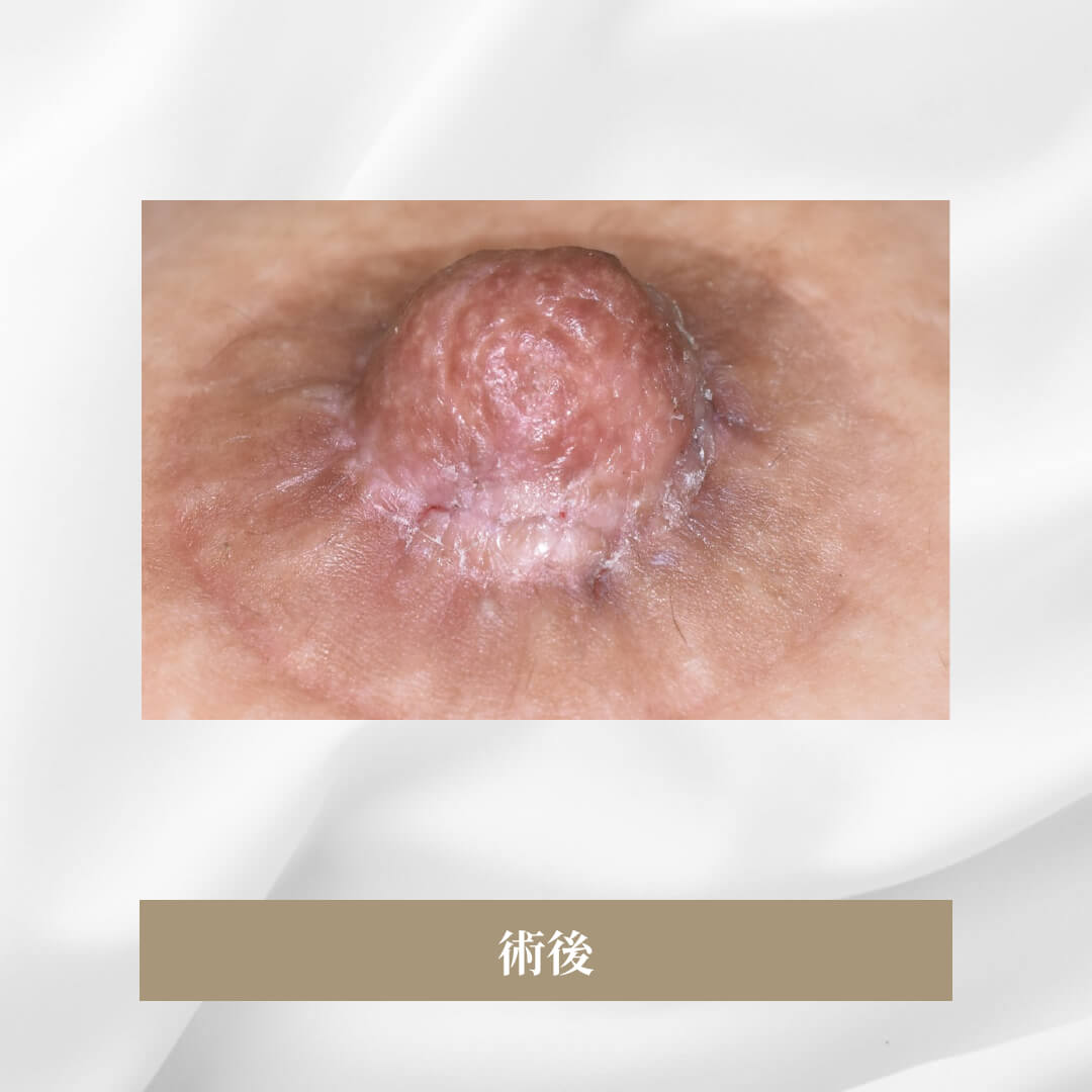 他院で2回手術治療をしたが、良い結果が得られなかった