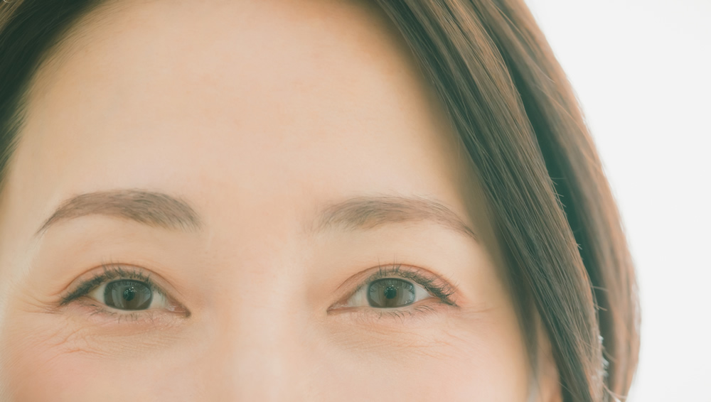 眉間の傷痕を修正した女性
